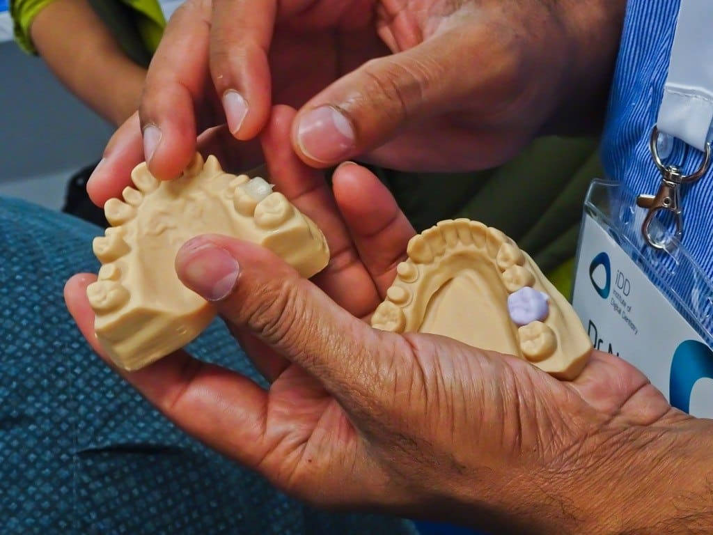 Introduction To CAD/CAM Dentistry Scan, Design, Mill