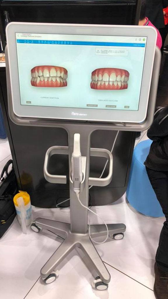 IDS-2019-Day3-itero-element-5d-intra-oral-scanner