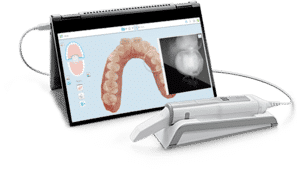 align-itero-element-5d-itero-element-5d-wand-intra-oral-scanner-ids-2019-institute-of-digital-dentistry-500x281