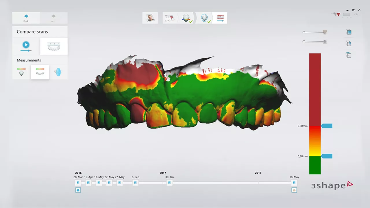 Patient-monitoring-3shape-TRIOS-4-Institute-of-digital-dentistry