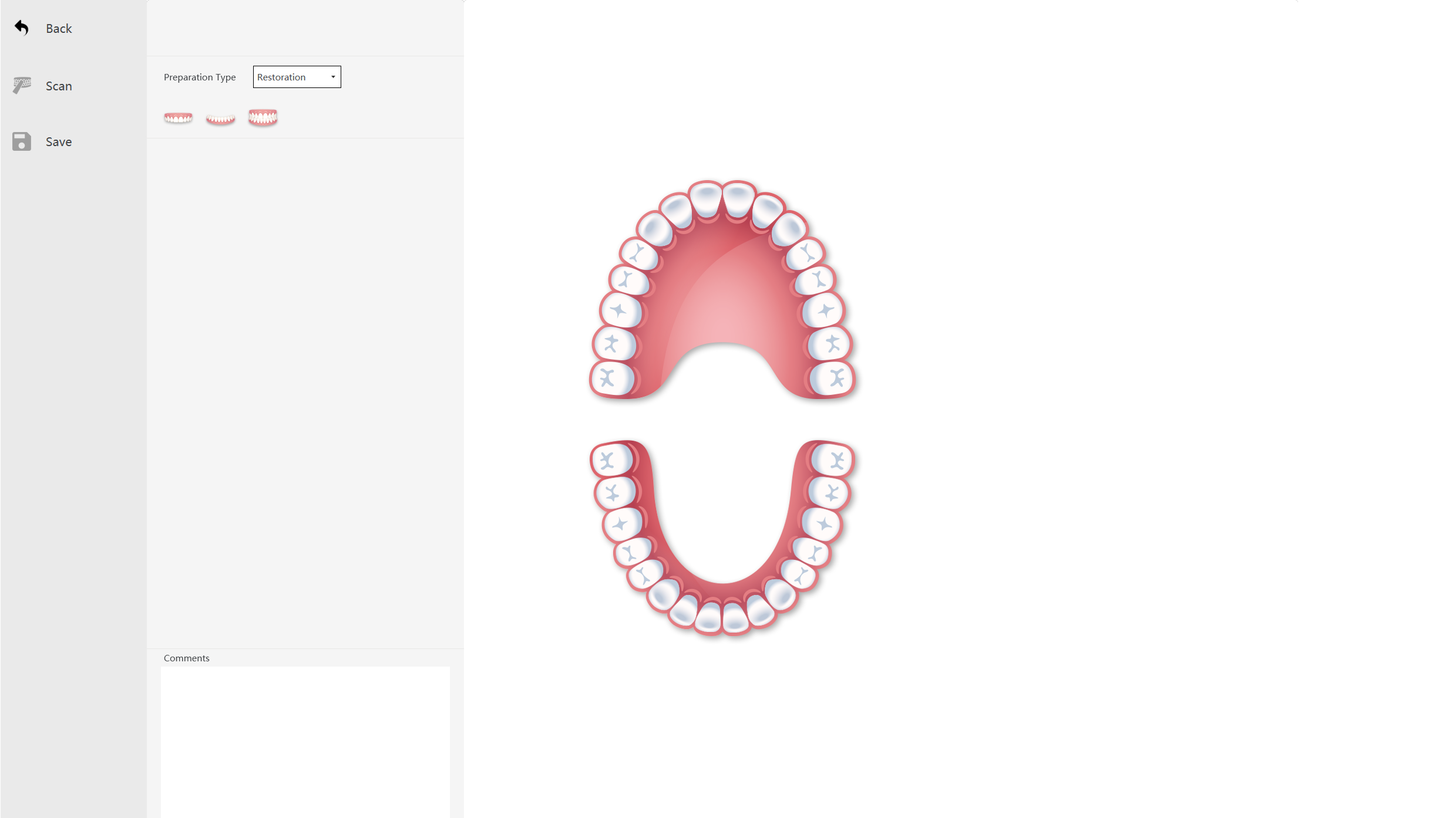 Runyes-intra-oral-scanner-low-cost-UI-institute-of-digital-dentistry (2)