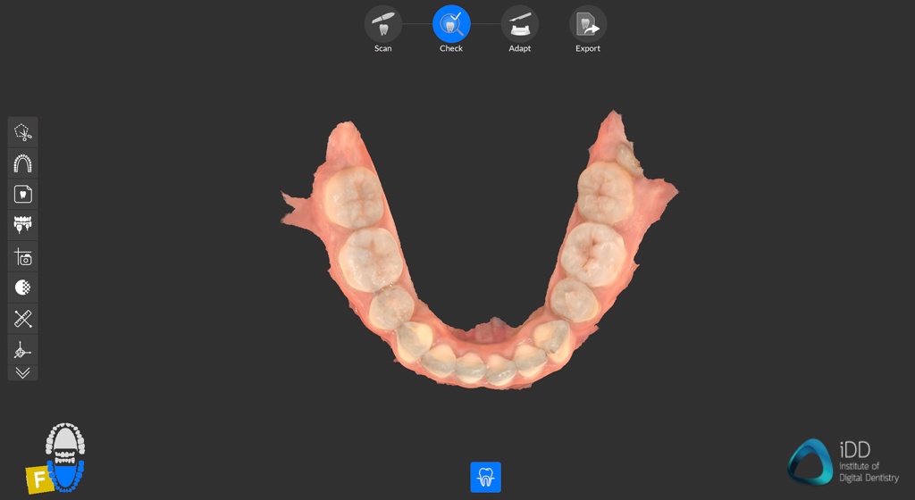 cs 3700 full arch scan institute of digital dentistry (2)