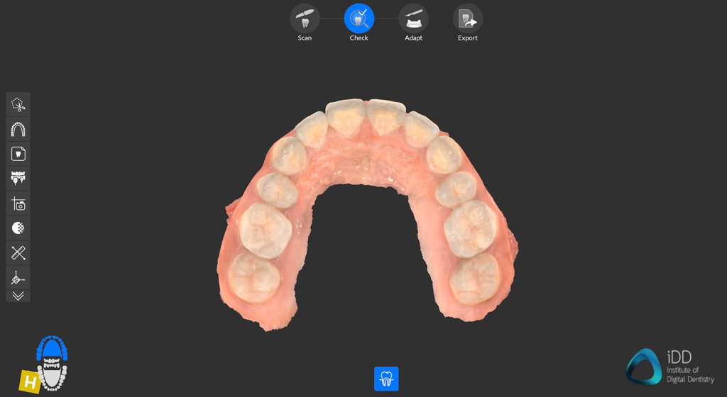 cs 3700 full arch scan institute of digital dentistry