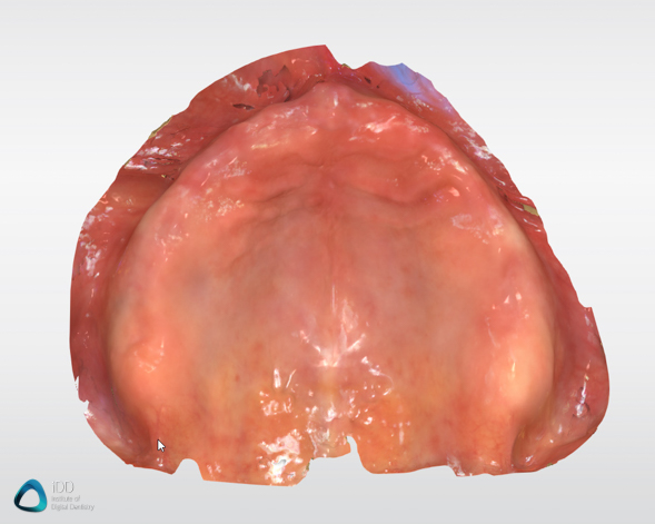 CEREC Full arch scans Primescan review institute of digital dentistry (2)