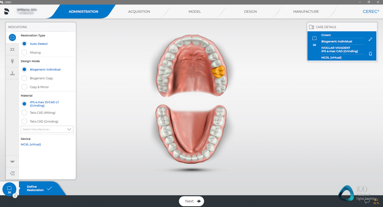 CEREC workflow CEREC Primescan review institute of digital dentistry