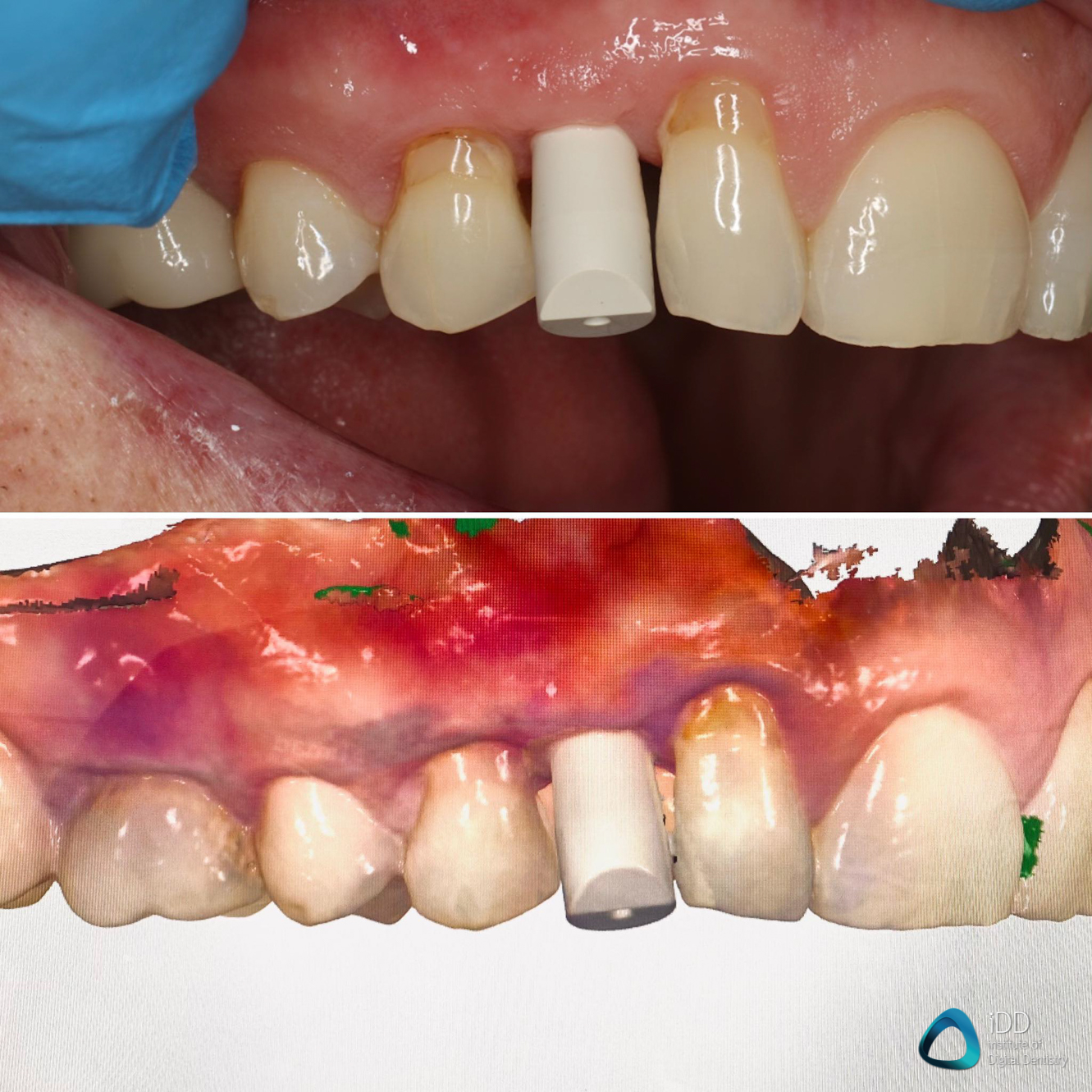 iDD Getting Started with Digital Dentistry Course (1)-2