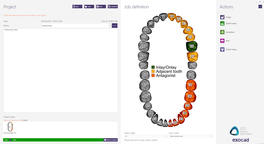 exocad crown workflow institute of digital dentistry (1)