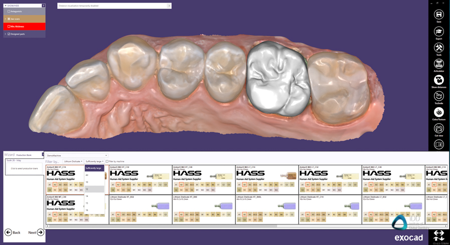 exocad crown workflow institute of digital dentistry (3)