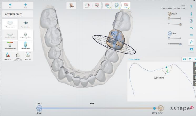 TRIOS Patient Monitoring 2