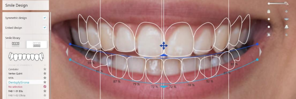 TRIOS Smile Design