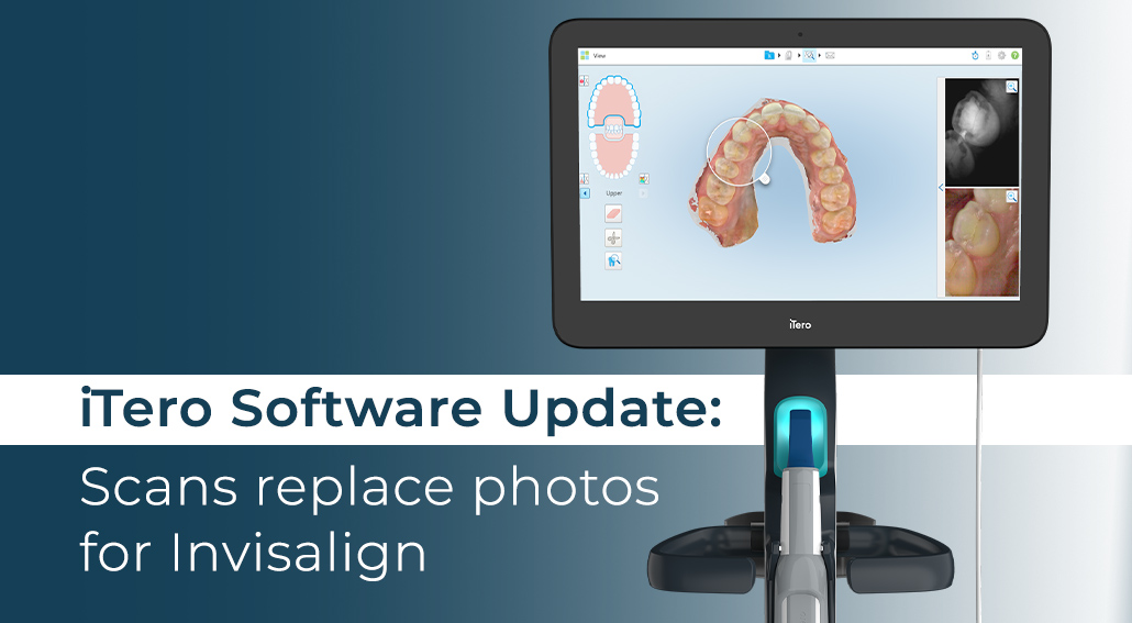 iTero New Software Release Workflow 2.0 iDD