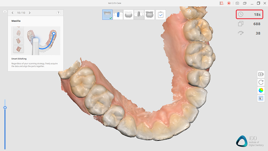 Medit i700 Full Arch Scan Institute of Digital Dentistry 2