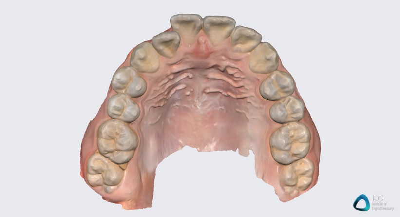 medit link software orthodontic simulator, model base creator, medit i700 institute of digital dentistry (11) 2