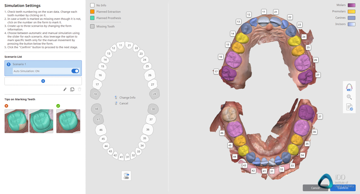 medit link software orthodontic simulator, model base creator, medit i700 institute of digital dentistry (15)