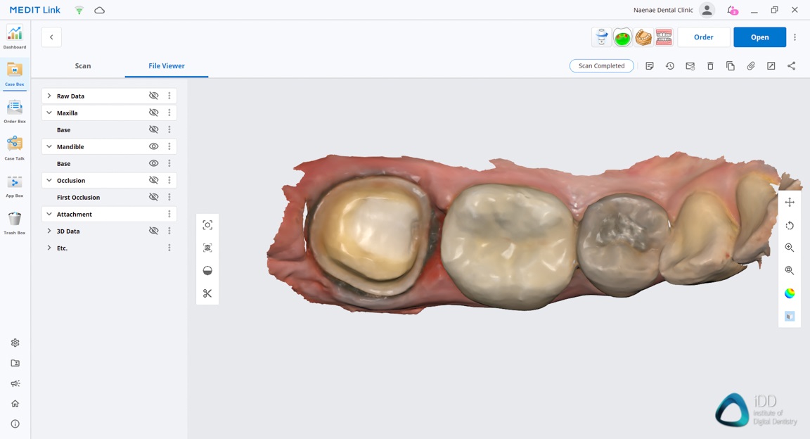 medit link software orthodontic simulator, model base creator, medit i700 institute of digital dentistry (16)