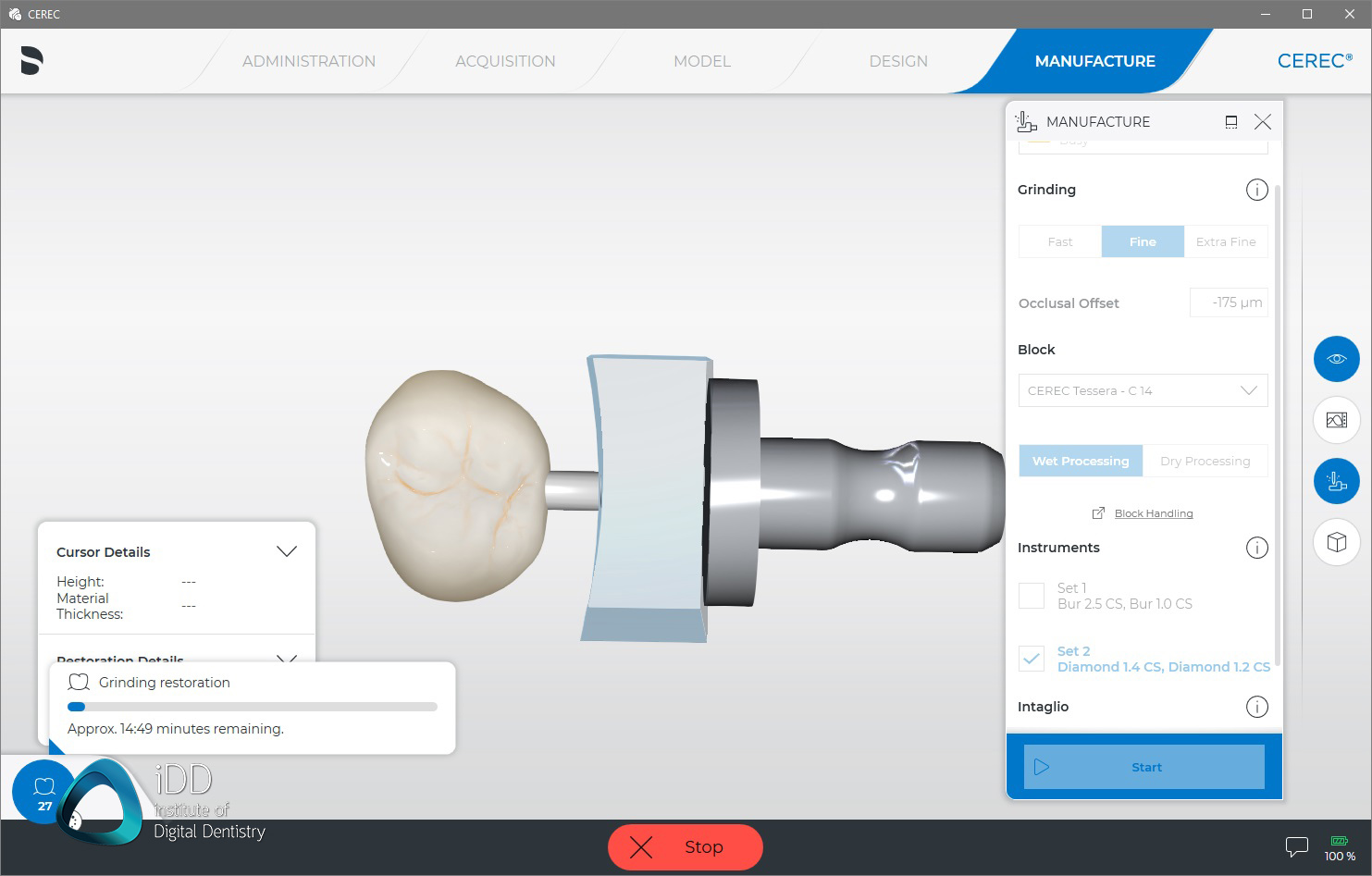 CEREC Test Crown