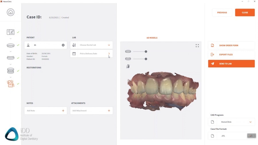 Heron IOS 3DISC Review Institute of Digital Dentistry (6)