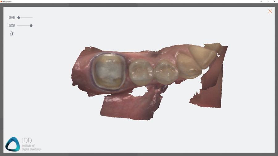 Heron Review Institute of Digital Dentistry Software (8)