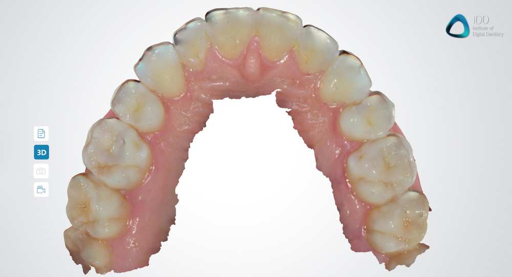 full arch scans dentaLink IOS fussen institute of digital dentistry (3)