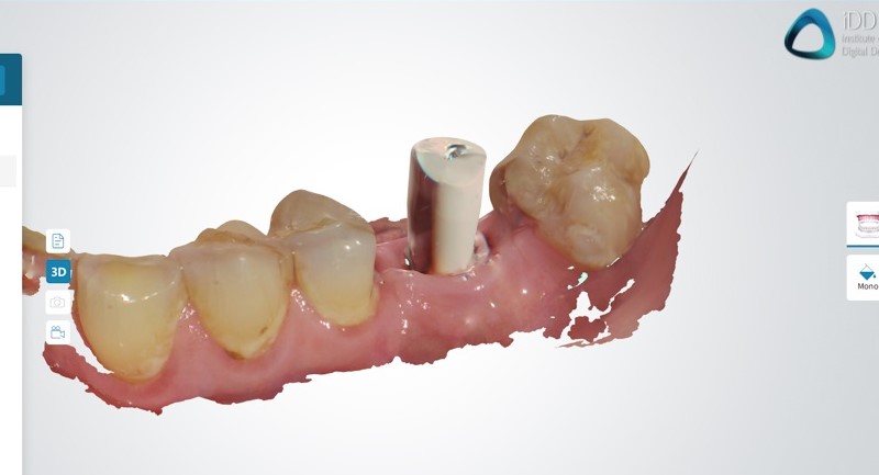 DENTAL_LINK_FUSSEN_SOFTWARE_INSTITUTE_OF_DIGITAL_DENTISTRY (16)