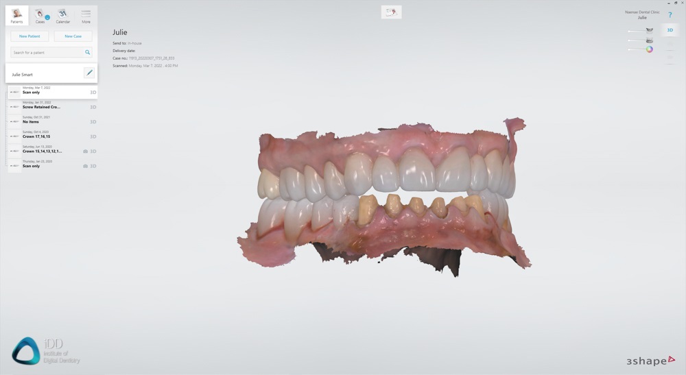 3Shape Unite Before and After Institute of Digital Dentistry (3)