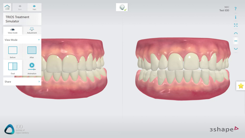 3shape_unite_platform_institute_of_digital_dentistry_TRIOS (14)