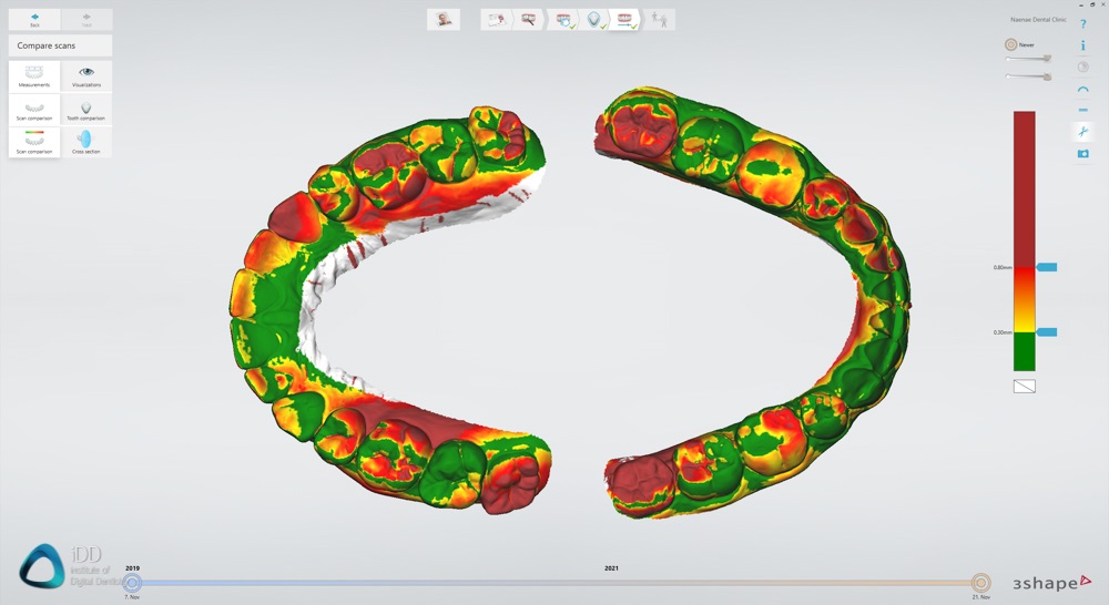 Patient Monitoring 3Shape TRIOS Institute of Digital Dentistry (2)