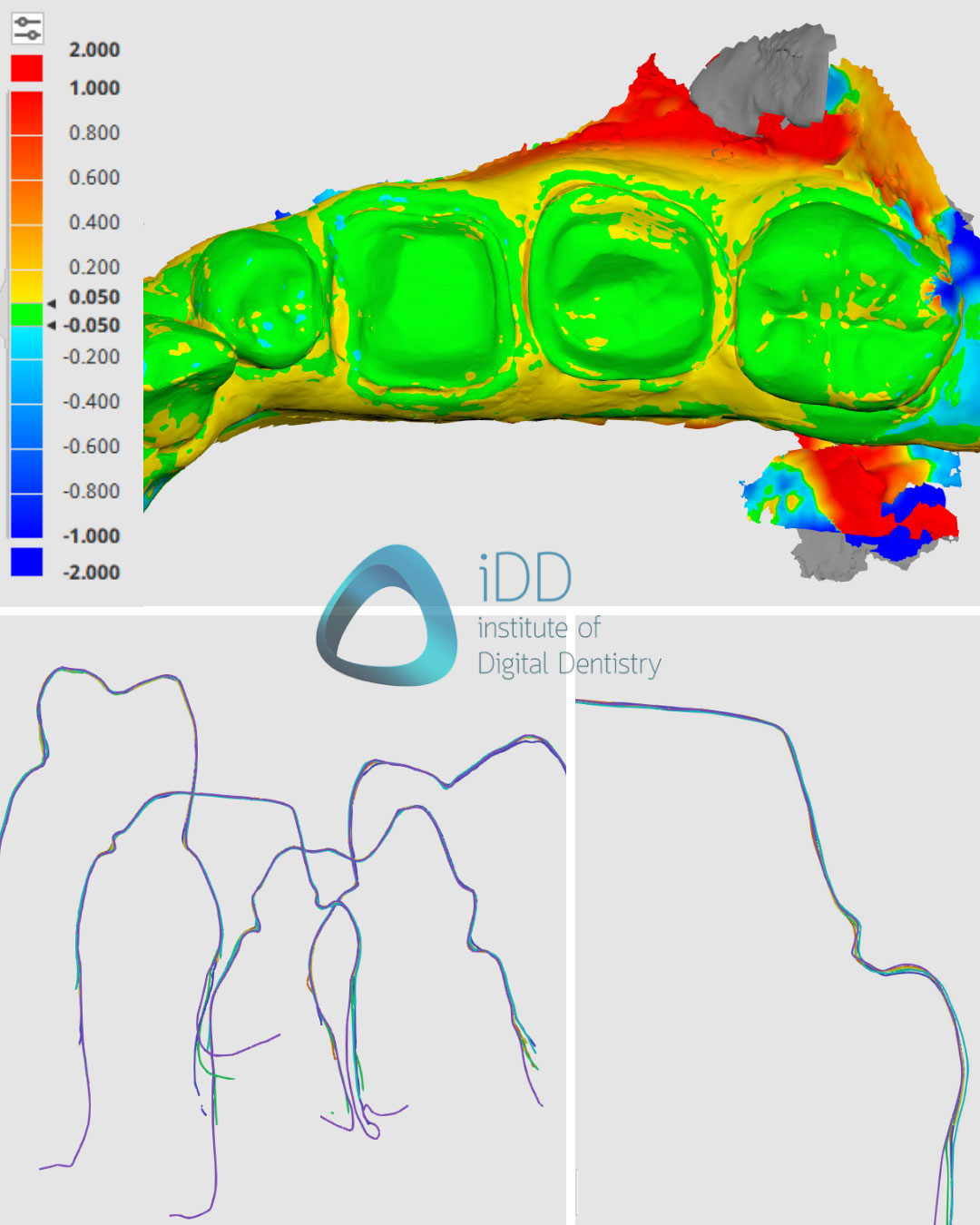 crown-prep-tooth-scan-test-cross-section-accuracy-Shining-3D-Aoralscan-3-vs-CEREC-Primescan-vs-Helios-600-vs-medit-i700-vs-launca-dl-206p-intraoral-scanner-comparison