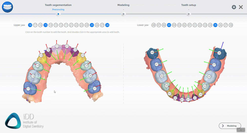 aoralscan-3-review-shining-3d-orthodontic-simulator-model-builder (16)