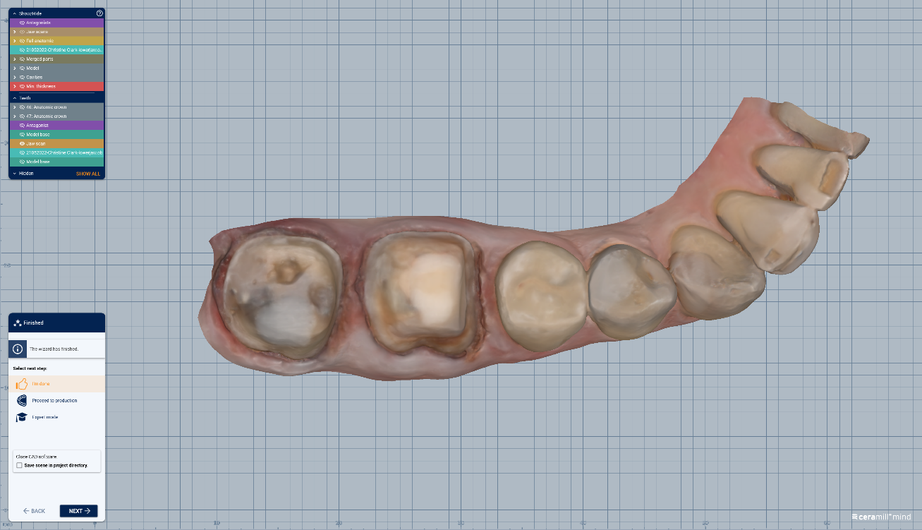 Figure 5. PLY scans exported from the Medit i700 Wireless and imported into exocad software for CAD designing. 