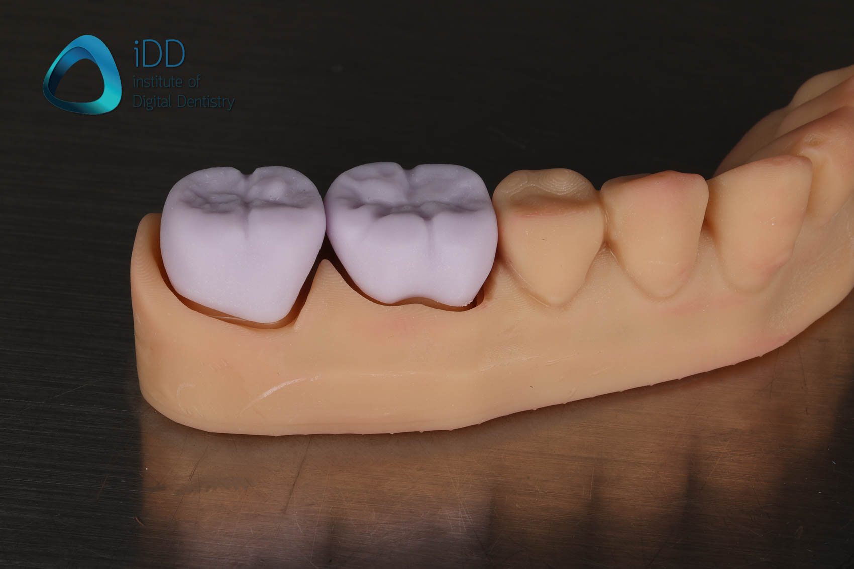 Figure 9. IPS e.max crowns before and after post-processing including ceramic characterisation, glazing and firing.