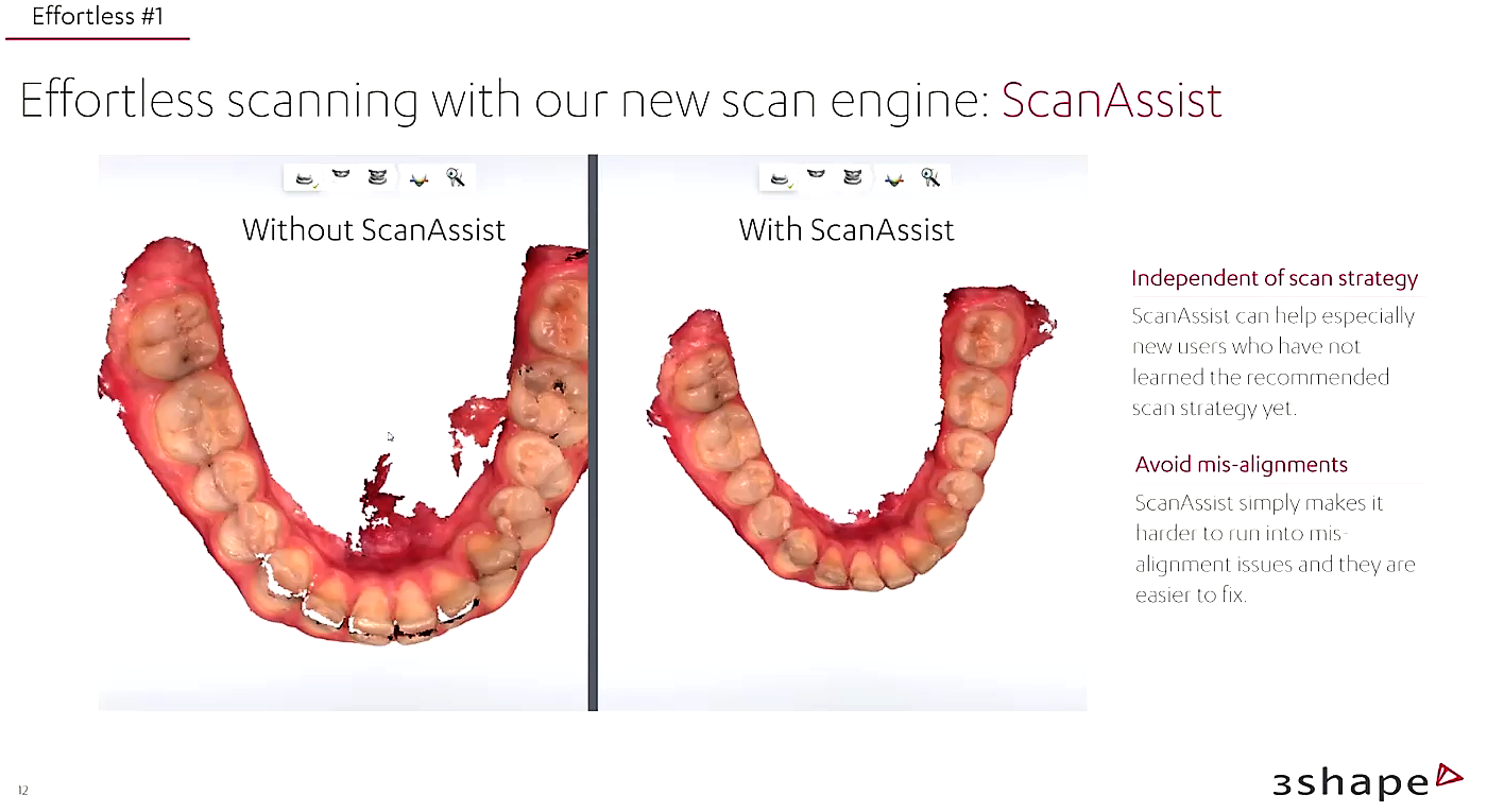 3shape trios 5 launched the new intraoral scanner by 3shape institute of digital dentistry iDD (17)