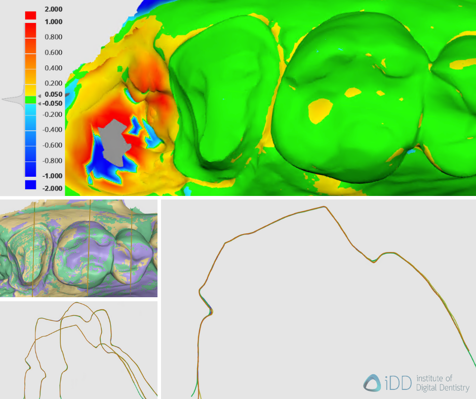 Deviation map of the scans as compared to TRIOS 5’s reference scan and sectional view.