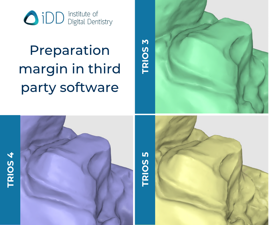 TRIOS 3, TRIOS 4, and TRIOS 5 by 3Shape Mesiobuccal prep margin of each scan as previewed in the Medit Design app.