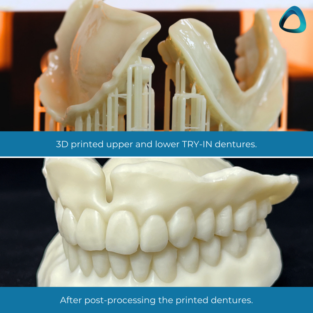 Digital Workflows for Digital Dentures