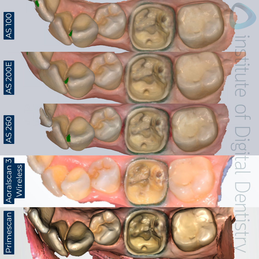 Color-native-scan-Alliedstar-AS-100-AS200E-AS-260-SHINING-3D-Aoralscan-3-Wireless-Dentsply-Sirona-CEREC-Primescan-iDD-Compares-Institute-of-Digital-Dentistry-1x1-1