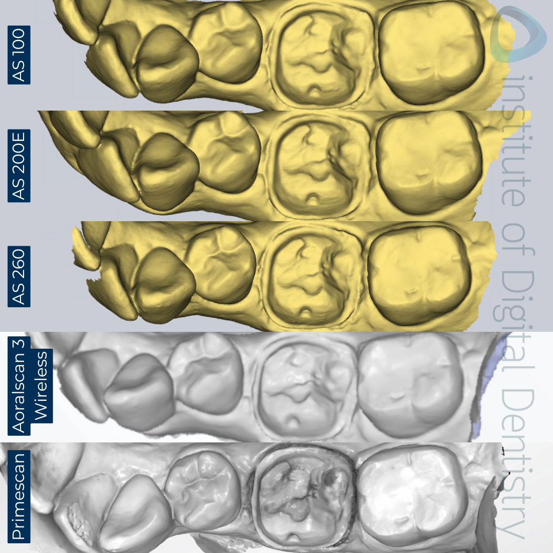 Monochrome-native-scan-Alliedstar-AS-100-AS200E-AS-260-SHINING-3D-Aoralscan-3-Wireless-Dentsply-Sirona-CEREC-Primescan-iDD-Compares-Institute-of-Digital-Dentistry-1x1-1