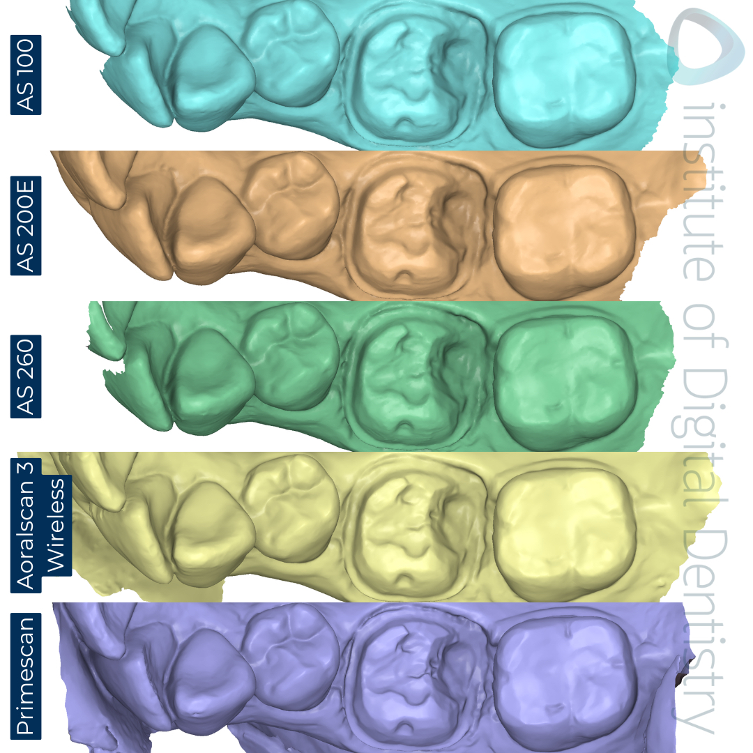 STL-scan-medit-design-Alliedstar-AS-100-AS200E-AS-260-SHINING-3D-Aoralscan-3-Wireless-Dentsply-Sirona-CEREC-Primescan-iDD-Compares-Institute-of-Digital-Dentistry-1x1-1