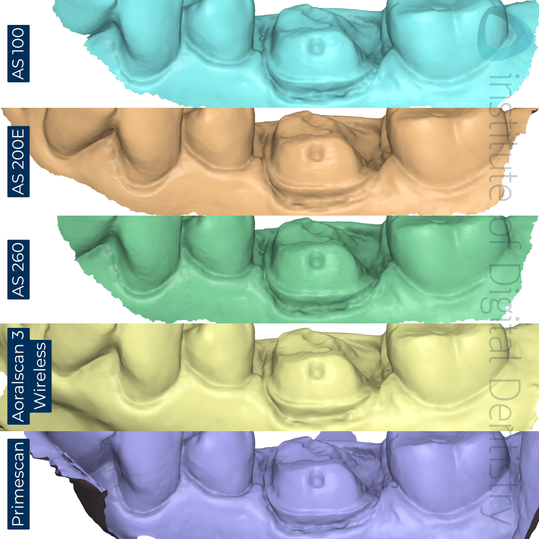 Buccal-margin-prep-Alliedstar-AS-100-AS200E-AS-260-SHINING-3D-Aoralscan-3-Wireless-Dentsply-Sirona-CEREC-Primescan-iDD-Compares-Institute-of-Digital-Dentistry-1x1-1