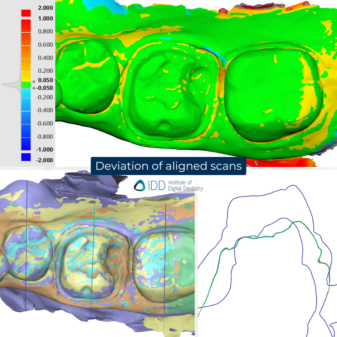 Deviation-analysis-Alliedstar-AS-100-AS200E-AS-260-SHINING-3D-Aoralscan-3-Wireless-Dentsply-Sirona-CEREC-Primescan-iDD-Compares-Institute-of-Digital-Dentistry-1x1-1