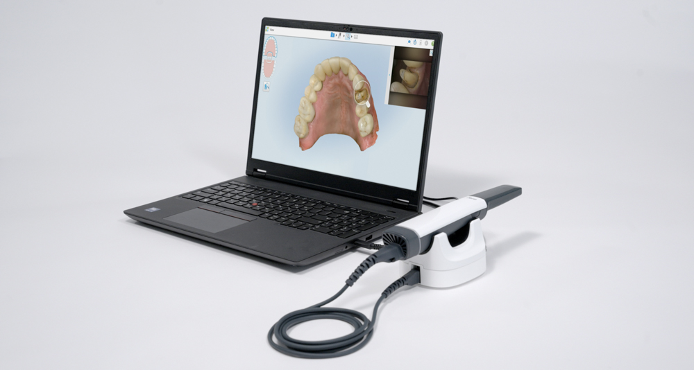 iTero Lumina Now Available as a PC Configuration Scanner | iDD